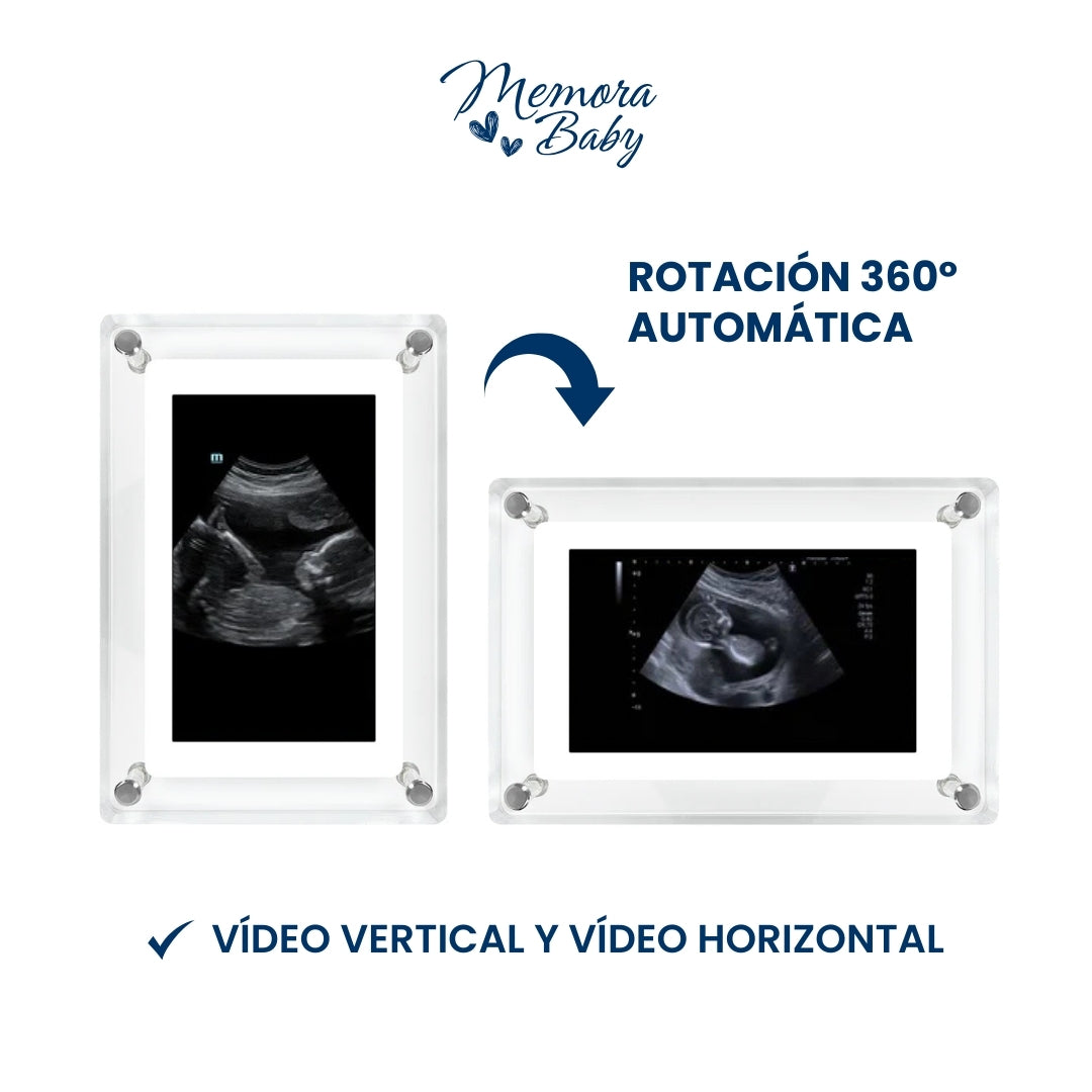 Marco digital MemoraBaby